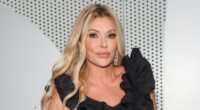 Brandi Glanville and Her New Doctor Detail Facial Disfiguration Treatment