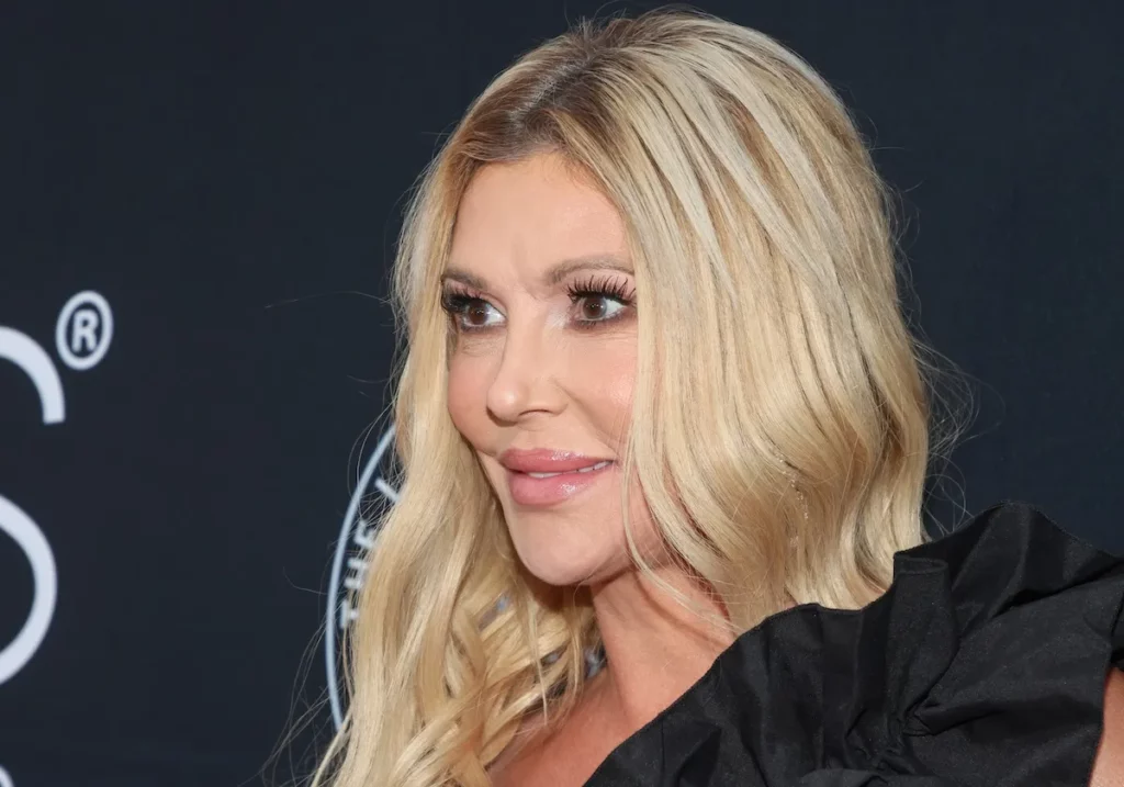 Brandi Glanville’s DIY Nair Hack for Facial Parasite ‘Can Cause Chemical Burns,’ Doctor Warns