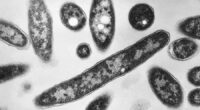 Death toll from Legionnaires' disease outbreak in New York City rises to 6 and infections hit 111