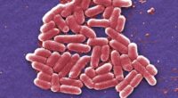 An increasing number of E. coli bacteria, shown here, are resistant to colistin, an antibiotic of last resort. (Credit: Janice Carr / Associated Press)