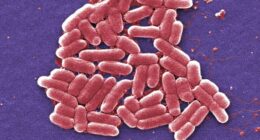 An increasing number of E. coli bacteria, shown here, are resistant to colistin, an antibiotic of last resort. (Credit: Janice Carr / Associated Press)