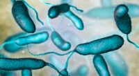 Flesh-eating bacteria at Florida beaches: What to know