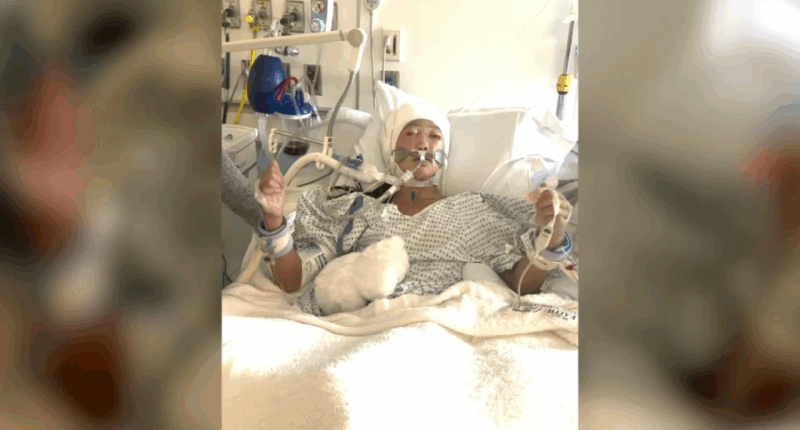 Girl dances to Taylor Swift while in coma