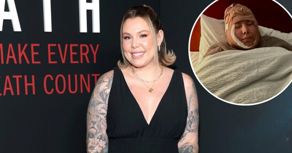 Kailyn Lowry Defends 'Double Chin' Removal, Shares Before and After Pics