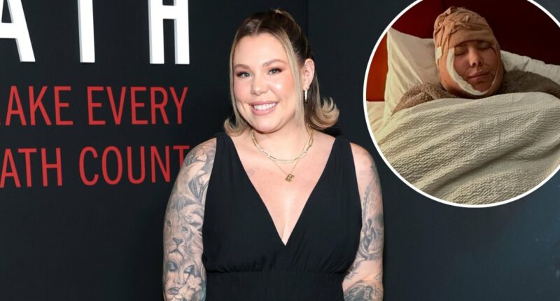 Kailyn Lowry Defends 'Double Chin' Removal, Shares Before and After Pics