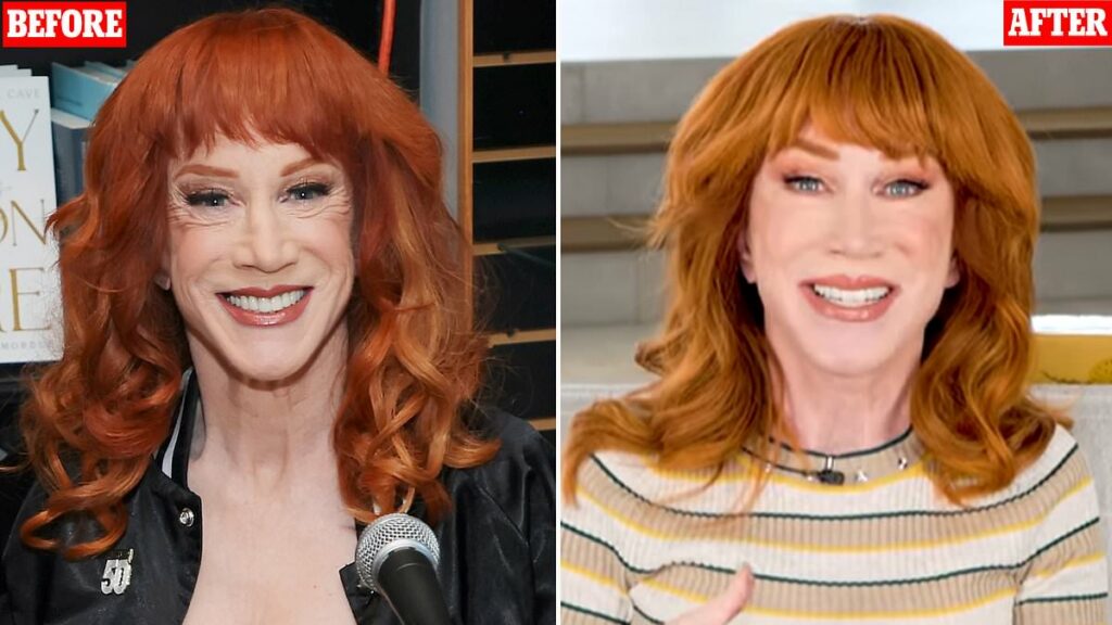 Kathy Griffin confirms she underwent THIRD face lift