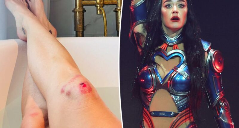 Katy Perry shows off brutally scraped knees she sustained during her ‘Lifetimes’ tour