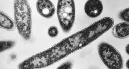 Officials confirm fourth death in NYC Legionnaires' outbreak