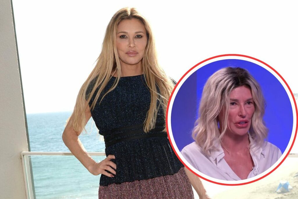 RHOBH's Brandi Glanville Shares Update on Facial “Parasite” After Spending Over $100K, Talks Suicidal Thoughts