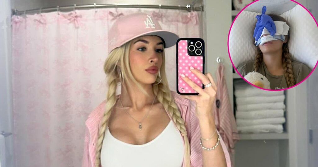 Sami Sheen Calls Her Rhinoplasty the ‘Best Decision’ 1 Year After Surgery