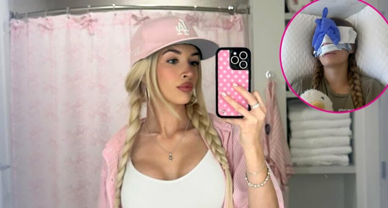 Sami Sheen Calls Her Rhinoplasty the ‘Best Decision’ 1 Year After Surgery