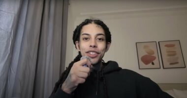 TikTok Star Shares Before and After Videos of Tongue-Splitting Surgery
