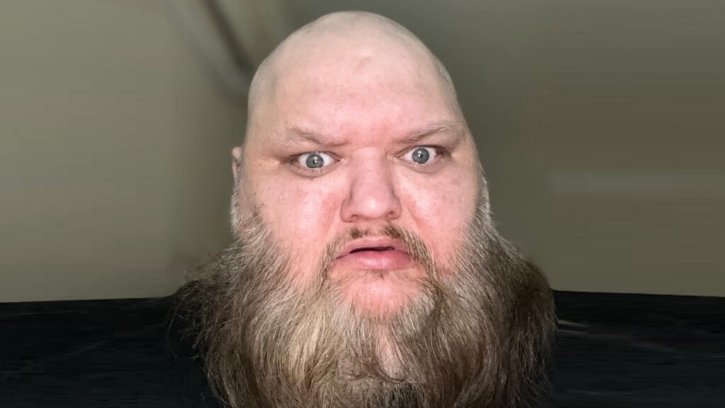 TikTok star John E Crawley’s cause of death at 47 is confirmed after influencer known as KingBeardX spent 2 weeks in ICU