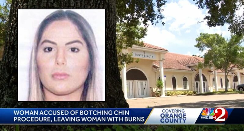 Unlicensed laser procedure burned woman's chin: Police