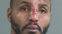 Ex-NFL star is seen with blood pouring down his face in police footage