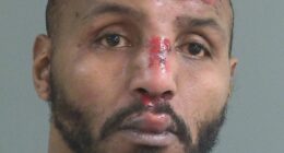 Ex-NFL star is seen with blood pouring down his face in police footage