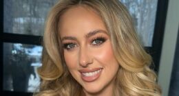 Plastic surgeons weigh in on Brittany Mahomes' changing look
