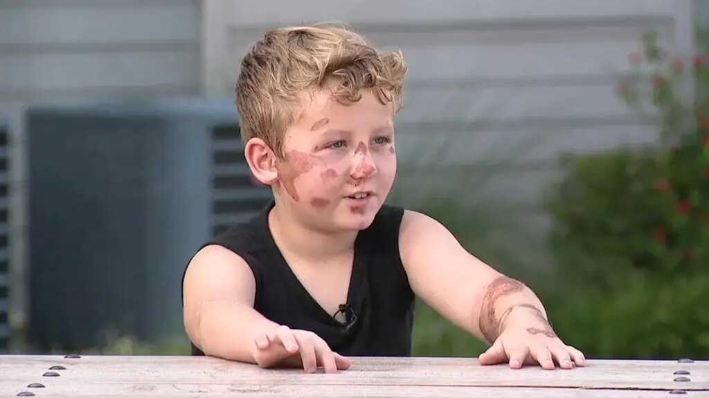 SUV driver runs over 8-year-old boy on bike, flees the scene after checking on injured child