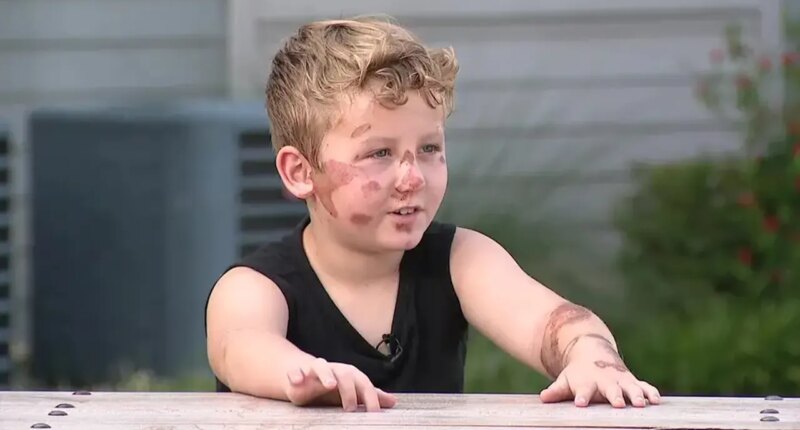 SUV driver runs over 8-year-old boy on bike, flees the scene after checking on injured child
