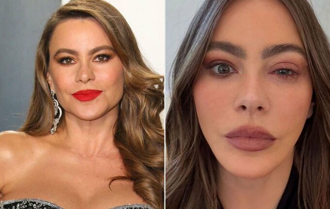 Sofía Vergara Misses 2025 Emmys Due to Eye Allergy ER Visit
