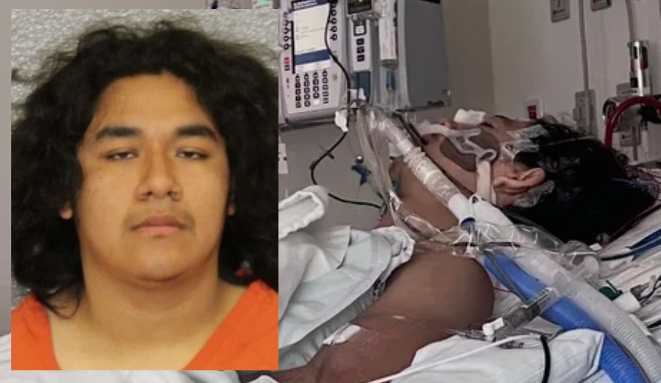 Teen Shot in the Face by ‘Friend’ Who Brought Guns to Sleepover