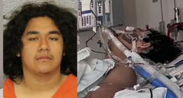 Teen Shot in the Face by ‘Friend’ Who Brought Guns to Sleepover