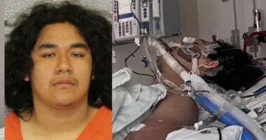Teen Shot in the Face by ‘Friend’ Who Brought Guns to Sleepover