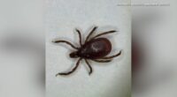Illinois could be facing 'tick invasion,' experts warn of possible increase in Lyme disease