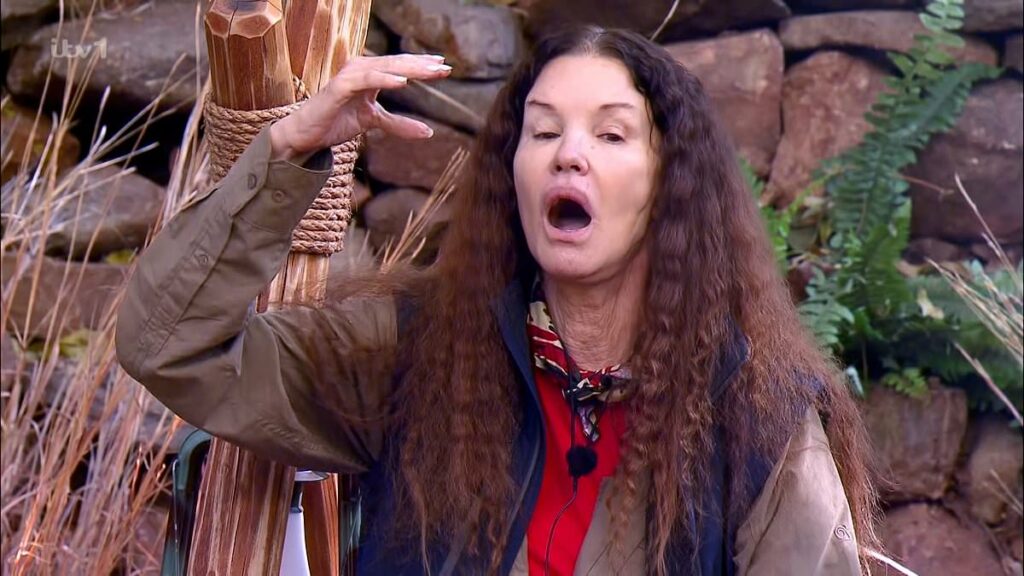 Janice Dickinson sues ITV over I'm A Celebrity accident