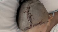 Parents speak out after Texas middle schooler suffers skull fracture in cafeteria