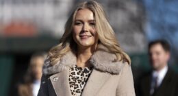 Plastic surgeons weigh in on Karoline Leavitt's rumored lip filler after debuting drastic new look
