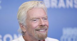 Richard Branson shows off nasty injury as he is pictured with face cut open