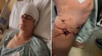 Texas woman survives brutal dog attack