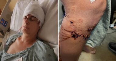 Texas woman survives brutal dog attack