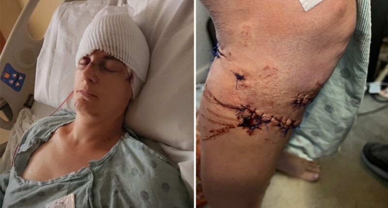 Texas woman survives brutal dog attack