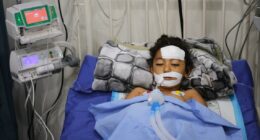A bomb in Gaza's rubble wounds twins who thought it was a toy
