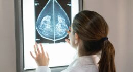 Early detection saves lives: Eligible women in Illinois can receive free mammogram screenings