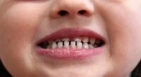 FILE - A child shows off her teeth after a dental exam in Concord, N.H., Wednesday, Feb. 21, 2024. (AP Photo/Robert F. Bukaty, file)