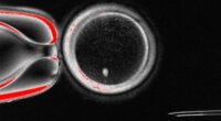 Fertility breakthrough as scientists create eggs from human SKIN cells