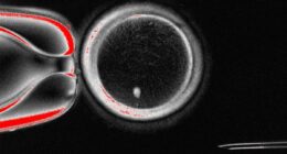 Fertility breakthrough as scientists create eggs from human SKIN cells