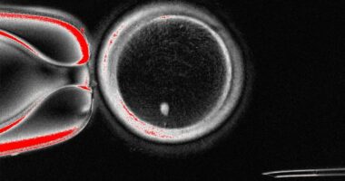 Fertility breakthrough as scientists create eggs from human SKIN cells
