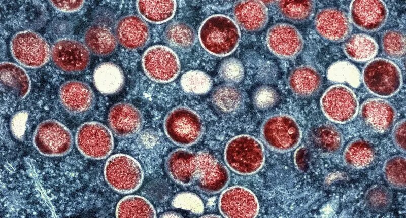 First case of more severe, easier transmitted Mpox strain reported in LA County