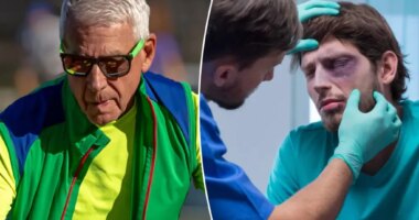 Fitness trend sending people to hospital at 'alarming rate'