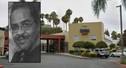 Man suffered 3rd-degree burns in shower at hotel: Lawsuit