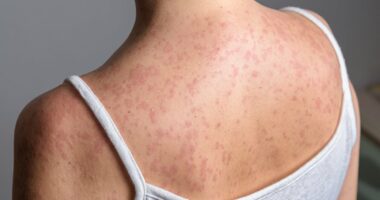 Measles outbreak spreads to new state as cases in US hit record high
