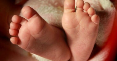 Mom Steamed Infant Daughter’s Face Until Her Skin Peeled Off Because She Wasn’t a Boy