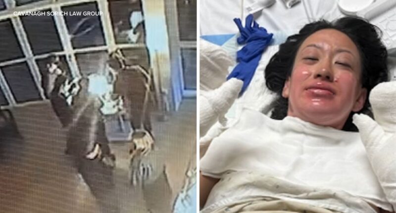 Navy Pier lawsuit: Kira Bond of New York seriously injured by s'mores fire sues Offshore Rooftop restaurant in Chicago