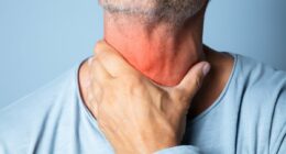 New Covid variants with unusual symptoms sweep the US