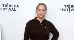 Amy Schumer Shows Off Weight Loss in New Pic: ‘Don’t Call It a Comeback’