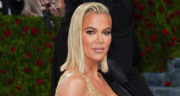 Khloe Kardashian's Extreme Plastic Surgery Is So Obvious In These Side By Side Photos